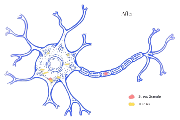 Post-treatment neuron
