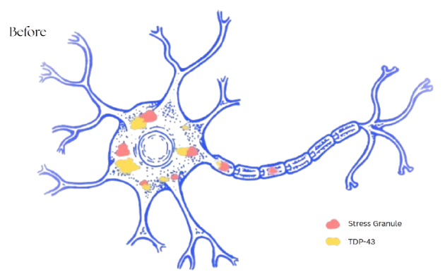 Untreated neuron